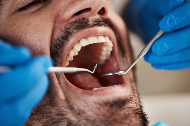 Best Pediatric Emergency Dentist in Eden Prairie, MN